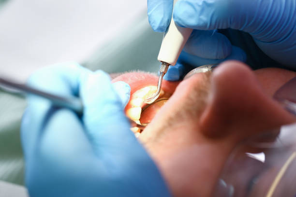 Best Weekend Emergency Dentist in Thomasboro, IL